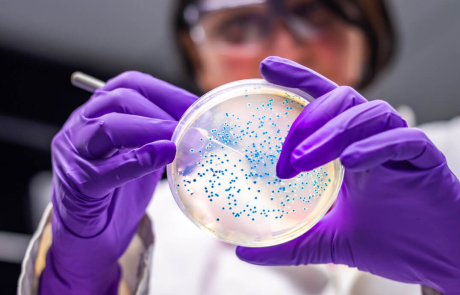 Blog Main Image - Researcher Woman Examining Culture Plate