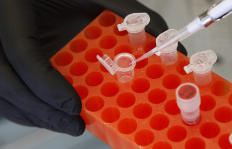 Blog Main Image - BRI Researcher Pipetting Samples 2