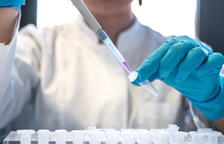 Blog Main Image - Researcher Woman Pipetting Samples Lab 2