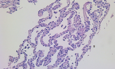 Mikacenic Research Project Preview - Macrophage Heterogeneity