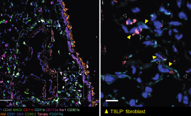 Ziegler Research Project Preview - Role of TSLP and IL33